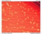 streptococcus anginosus